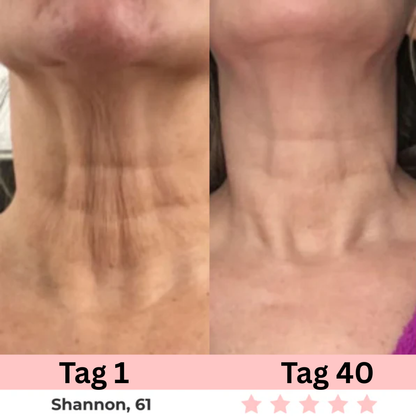 Luxera Pro – 7-in-1 LED Gesichtsstraffer